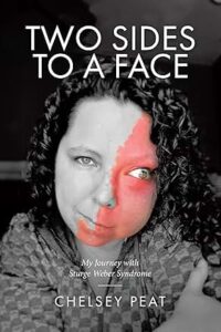 A book cover with Chelsey's face in Black and White, and her facial birthmark in the colour red. The top of the page reads "Two Sides Of A Face", the title of the book